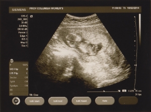 ultrasound 2014-10-23 2.jpg